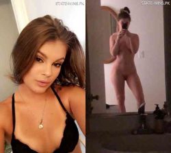 Milia Anderson